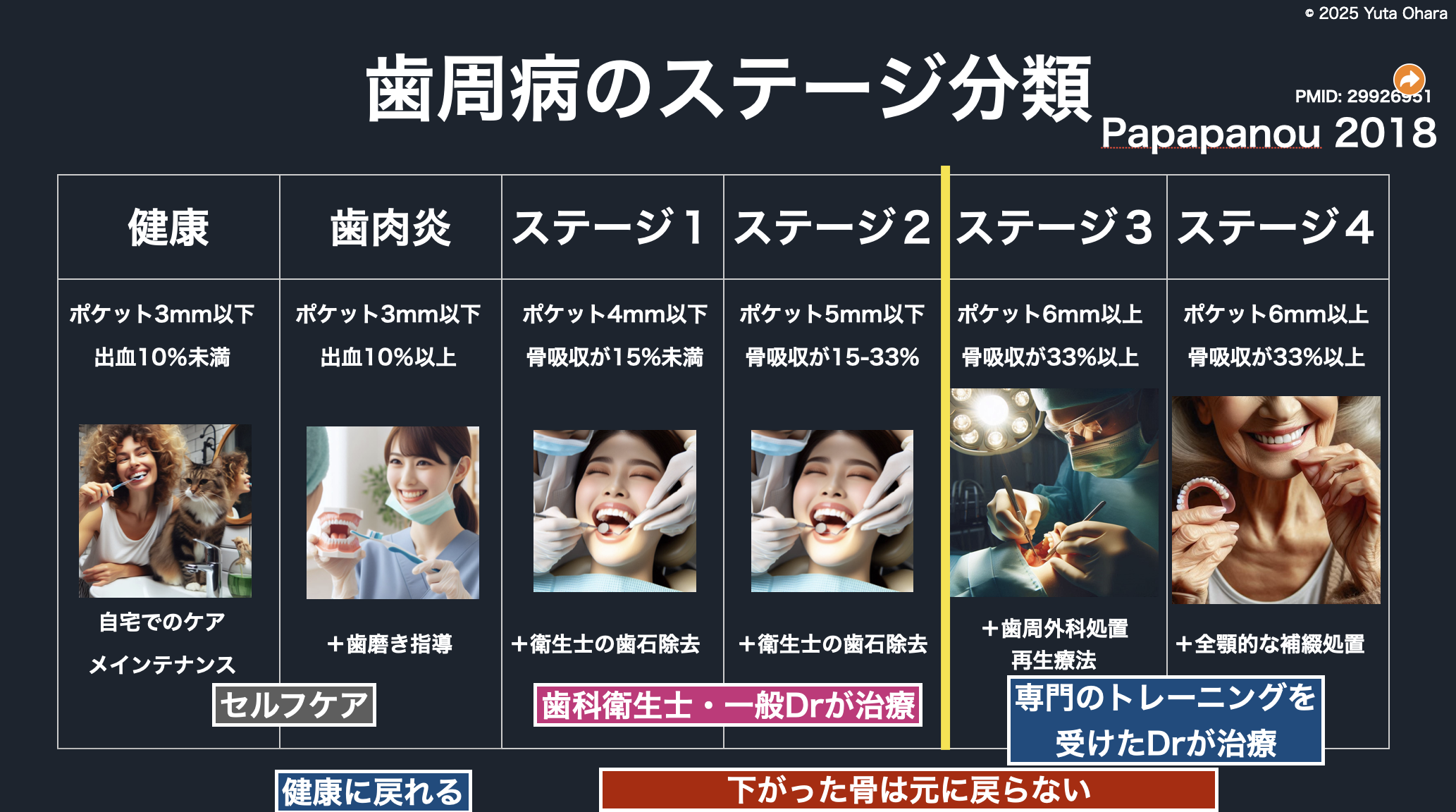 歯周外科治療イメージ