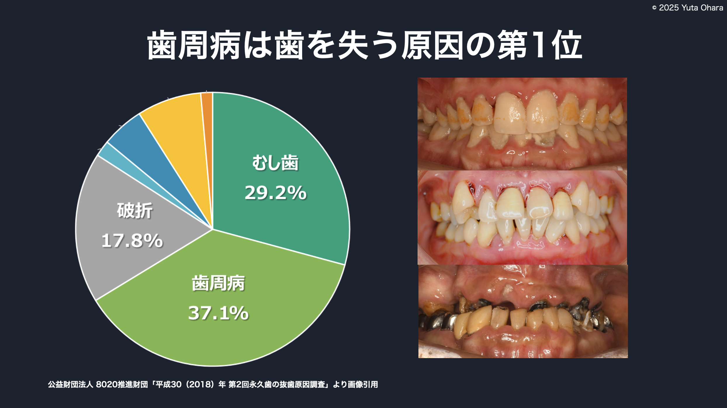テーマパーク8020より画像引用