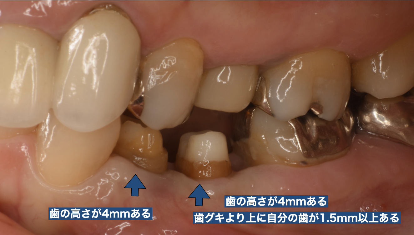 CleanShot 2025-10-26 at 18.23.23