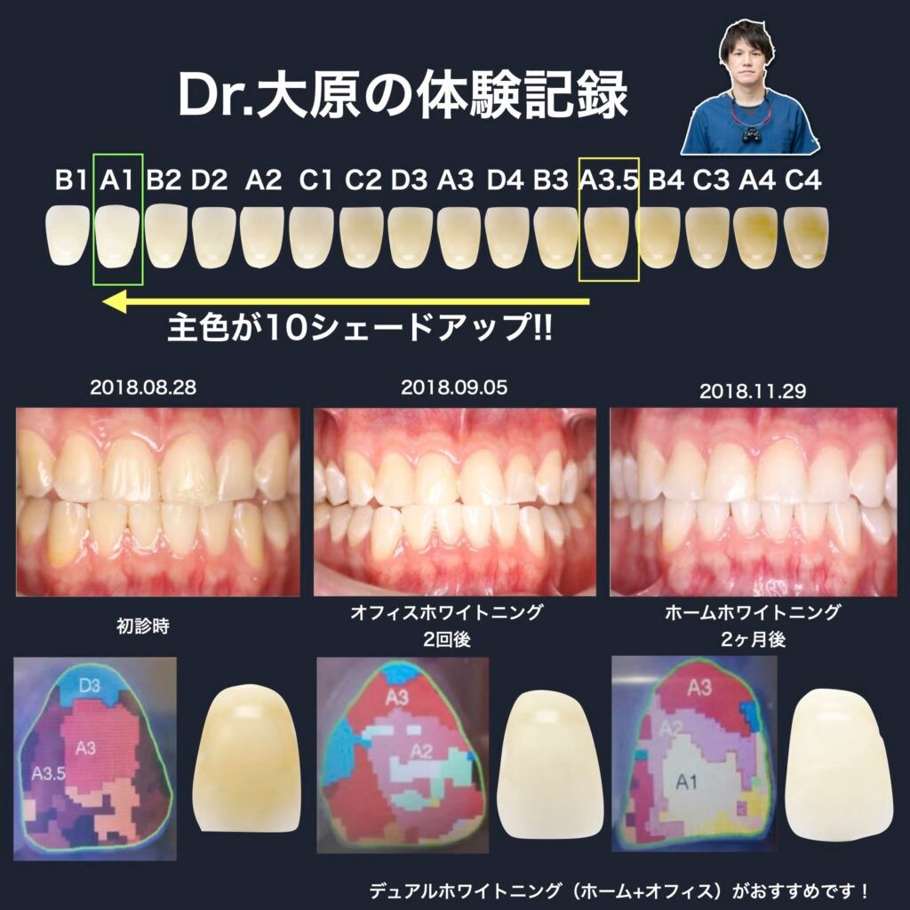 Dr.大原の体験記録